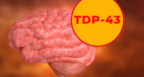 Co-aggregazione della Proteina TDP-43 con Altri Patogeni nelle Malattie Neurodegenerative